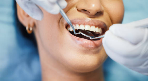 Best Cracked Tooth Emergency Dentist  in Villas, FL